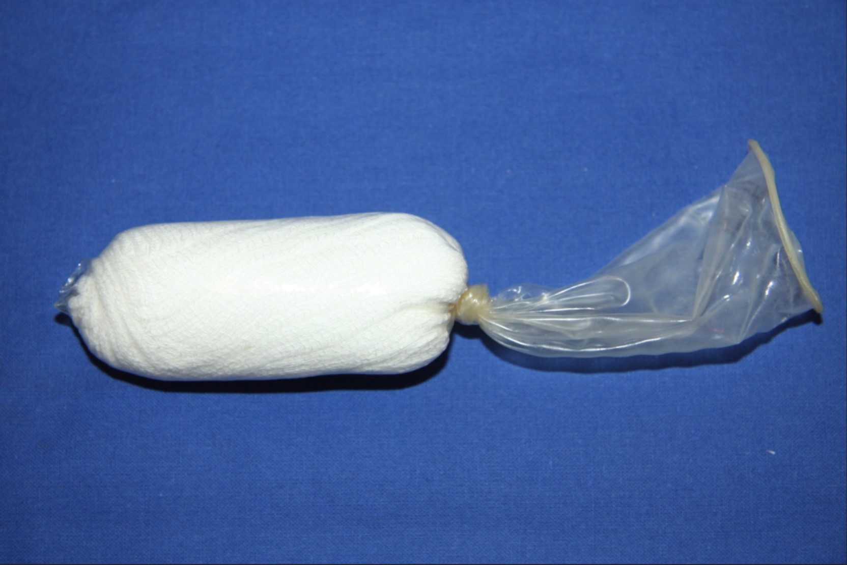 conformateur vaginal